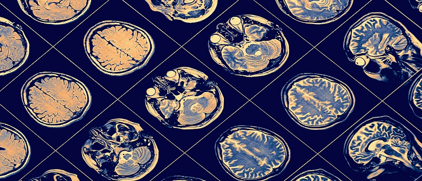 Brain scan prime.jpg